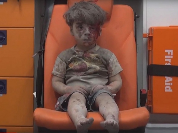 Nhói lòng hình ảnh cậu bé bị thương sau cuộc không kích ở Syria
