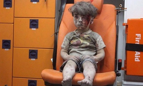 Cậu bé Syria bị thương làm dậy sóng mạng xã hội