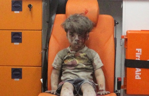 Mỹ gọi cậu bé Syria bị thương là "bộ mặt thật của chiến tranh"