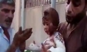 Phiến quân Syria đắp bùn chữa bỏng cho bé gái trúng bom
