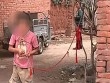 Bé gái 8 tuổi bị trói vào cây trong suốt 6 năm vì mắc bệnh lạ