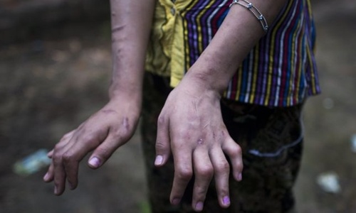 Hai thiếu nữ làm nô lệ suốt 5 năm gây phẫn nộ ở Myanmar
