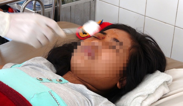 Bảo vệ nổ súng đạn cao su, một phụ nữ mang thai nhập viện