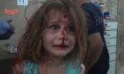Bé gái Syria mặt chảy máu, khóc gọi cha sau trận không kích