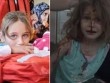 Tiếng gọi "Bố ơi" xé lòng của bé gái Syria với khuôn mặt đầy máu sau vụ nổ bom