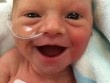 Nụ cười toe toét của em bé sinh non 5 ngày tuổi truyền cảm hứng khắp thế giới