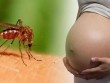 Phụ nữ chuẩn bị mang thai nên cân nhắc trước tình hình dịch Zika