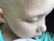 Sợi lông mi cuối cùng của bé gái mắc bệnh ung thư khiến nhiều người phải bật khóc