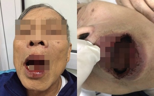 "Cán bộ Sở Ngoại vụ Hà Nội đánh tiến sĩ 76 tuổi nhập viện" nóng trên Vitalk