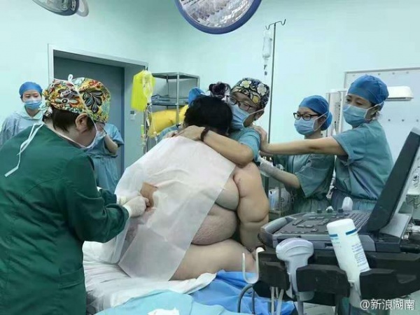 16 người loay hoay đỡ đẻ cho bà bầu "khổng lồ" 127 kg