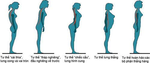 Nghiên cứu mới “bóc mẽ” nguyên nhân bạn bị đau lưng.
