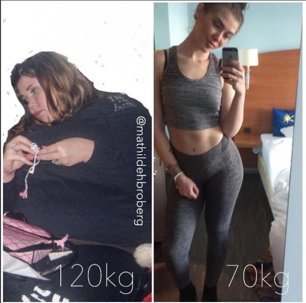 Nữ sinh Đan Mạch béo phì gây choáng khi giảm gần 60kg
