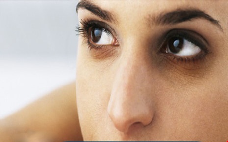 Quầng thâm ở mắt rất có thể là dấu hiệu bệnh gan, thận