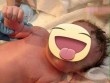Sự cố cười ra nước mắt, em bé đẻ ra tay vẫn cầm chặt chiếc vòng tránh thai