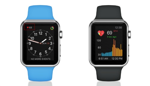 Apple Watch giúp phát hiện ra nguy cơ suy tim cực chính xác