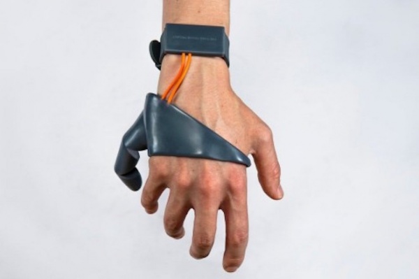 Công nghệ cho phép gắn thêm ngón tay nhân tạo để bàn tay có 6 ngón