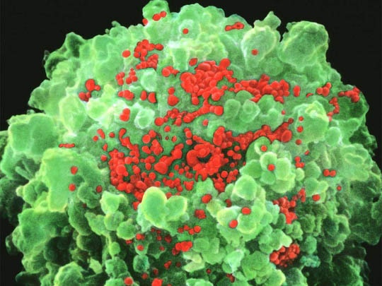 Tìm ra loại thuốc khiến con người bớt sợ HIV