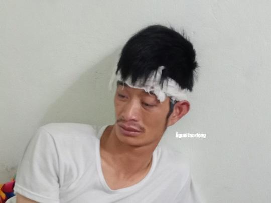 Gia cảnh khốn khó của tài xế taxi Mai Linh bị lái xe Mercedes đánh nhập viện
