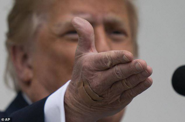 Bức ảnh tiết lộ dấu hiệu lạ trên bàn tay ông Trump