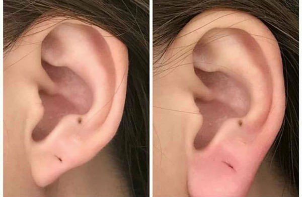 Rộ trào lưu làm tai tài lộc mong thay đổi vận mệnh, chuyên gia cảnh báo: Cẩn thận nát tai