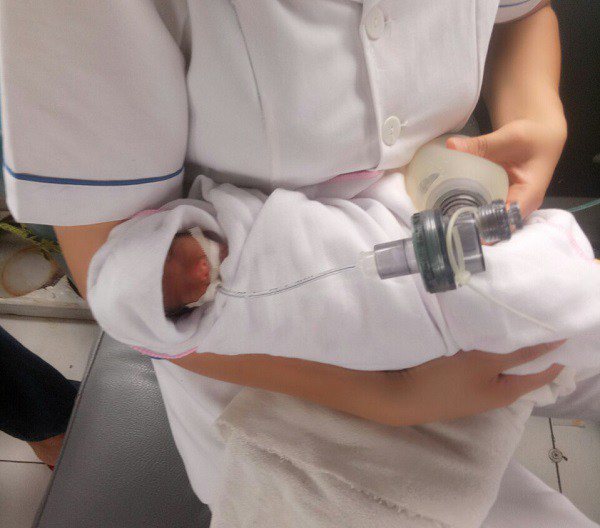 Em bé sơ sinh nhẹ cân nhất Việt Nam đón cái Tết đầu tiên với sự thay đổi bất ngờ