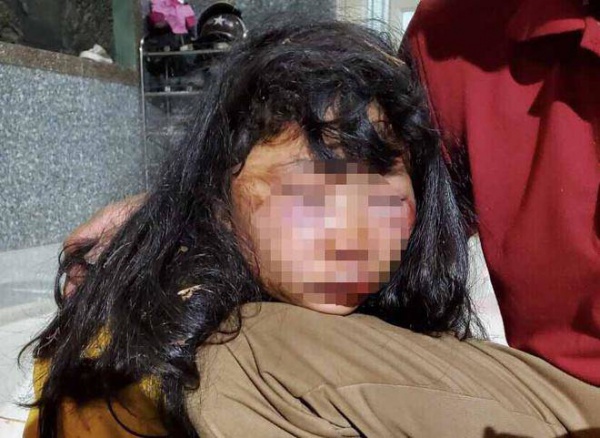 Nữ sinh lớp 6 bị giật tóc, đánh ngất xỉu trong lô cao su: Người thân tiết lộ bất ngờ