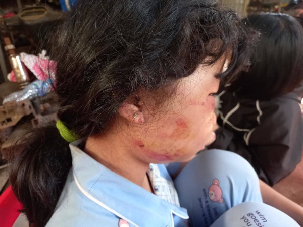 Đã bắt được kẻ đánh nữ sinh lớp 6 dã man trong lô cao su ở Bà Rịa-Vũng Tàu