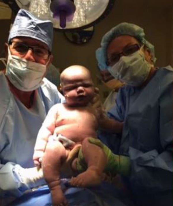 Em bé chào đời nặng 6,5 kg, hình ảnh hiện tại gây bất ngờ không kém