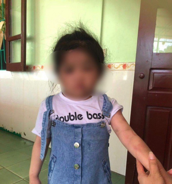 Thông tin mới vụ dì ruột dùng chổi sắt đánh bé gái 4 tuổi vì lười ăn
