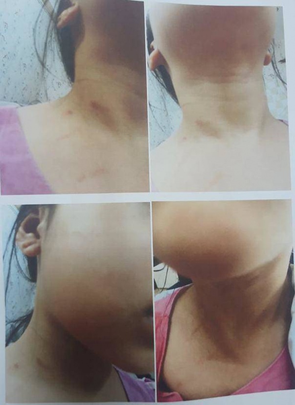 Nghi án hai bé gái bị bố dượng bạo hành ở Hà Nội