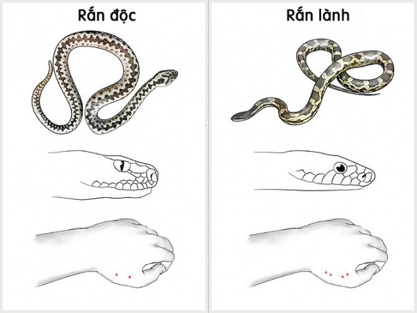 Cách giúp xử trí và sơ cứu hiệu quả khi bị rắn cắn
