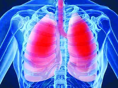 Tìm hiểu về bệnh viêm phổi và cách phòng ngừa viêm phổi