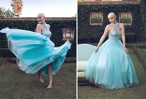 Ung thư không ngăn cô gái 17 tuổi xinh như công chúa
