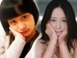 Sau 5 năm, người mẫu teen Trung Quốc từng bị thiêu sống vì tình lộ diện