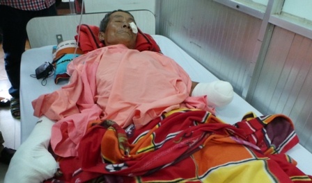 Vụ đạn nổ ở Đắk Lắk: Cha mất tay, con cụt chân