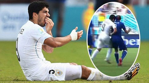 Rugby: Cấm thi đấu 1 năm vì 2 lần cắn đối thủ như Suarez