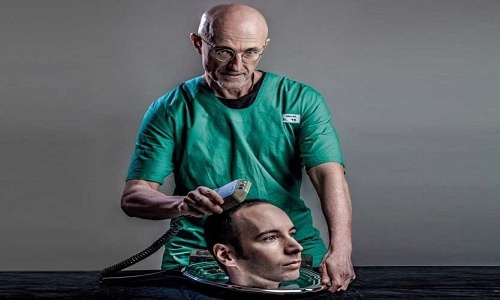 Bác sĩ Italy chứng minh phẫu thuật ghép đầu có thể thành công
