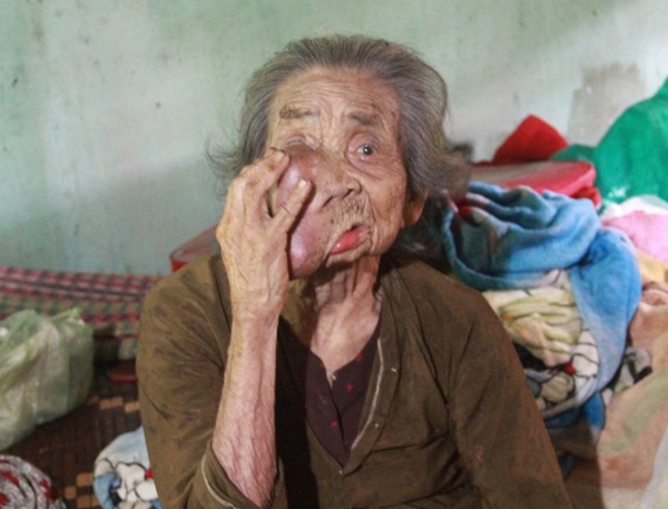 Gặp cụ bà 92 tuổi có ‘khuôn mặt quỷ’