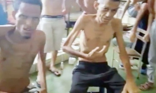 Tù nhân Venezuela da bọc xương cầu cứu cùng thi thể chết đói
