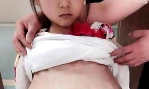 Bé gái 12 tuổi mang thai ở Trung Quốc "nói ít tiếng Việt"