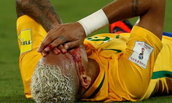Neymar: ‘Sẽ tiếp tục phô diễn, ghét cứ đánh cùi chỏ’