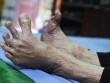 Bắc Ninh: Cụ ông 105 tuổi có bàn chân kỳ lạ