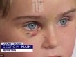 Người đàn ông bại não ở Úc tấn công bé gái 5 tuổi vì ham muốn tình dục