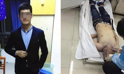 Thạc sĩ Trung Quốc đột tử vì bị ép rượu tất niên gây rúng động