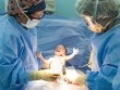 Bác sĩ cắt cụt ngón tay trẻ sơ sinh trong quá trình mổ lấy thai