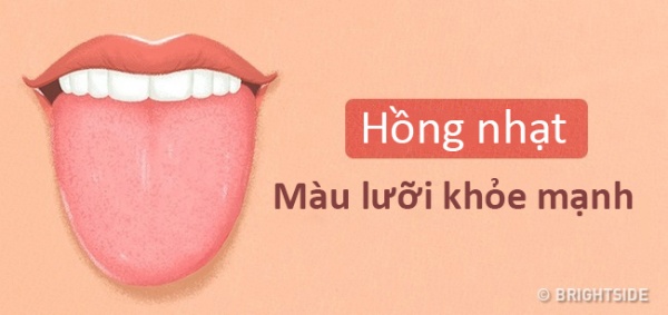 Màu lưỡi nói lên tình trạng sức khỏe của bạn thế nào?