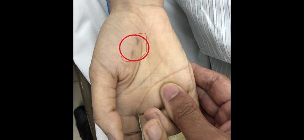 Hà Nội: Nữ bác sĩ thú y tử vong sau gần 2 tháng bị chó ốm cắn vào tay