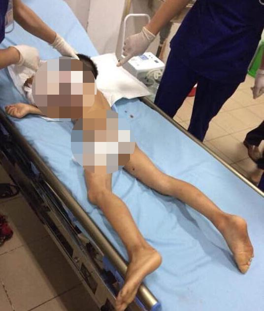 Thái Nguyên: Bé trai 7 tuổi bị chính chó nhà nuôi cắn tử vong