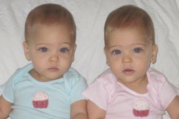 Cặp song sinh đẹp nhất thế giới, 6 tháng tuổi đã đi quảng cáo giờ ra sao?