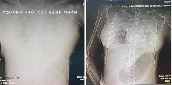 Nghi án cô gái tử vong sau khi nâng ngực: Vì sao bác sĩ chi 20 triệu nhờ khâm liệm?